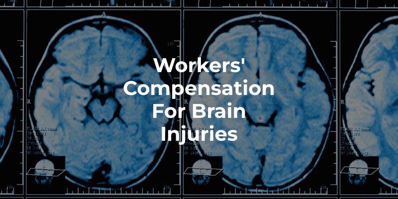 Workers' Compensation for Brain Injuries